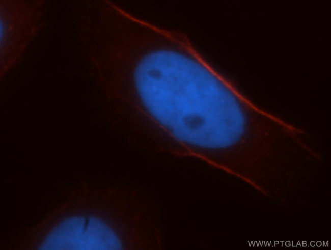 CNN3 Antibody in Immunocytochemistry (ICC/IF)