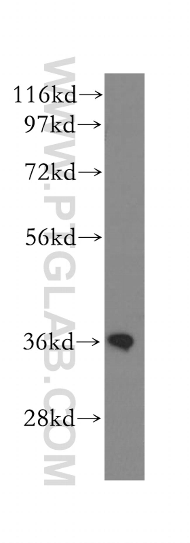 CNN3 Antibody in Western Blot (WB)