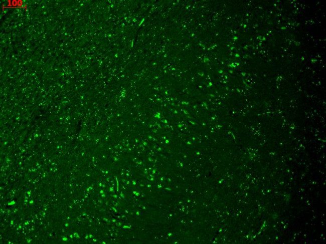 HCN4 Cyclic nucleotide-gated Channel Antibody in Immunohistochemistry (Paraffin) (IHC (P))