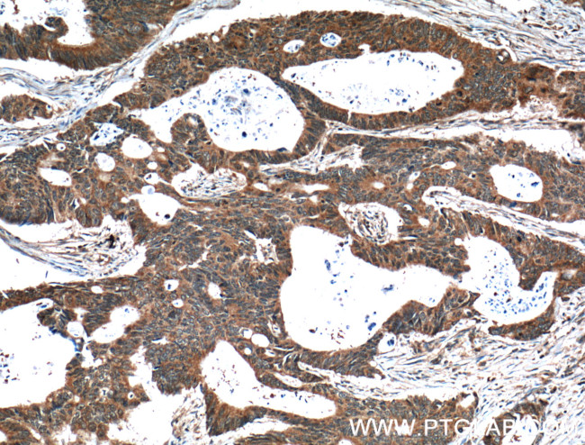 YME1L1 Antibody in Immunohistochemistry (Paraffin) (IHC (P))