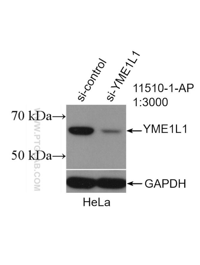 YME1L1 Antibody in Western Blot (WB)