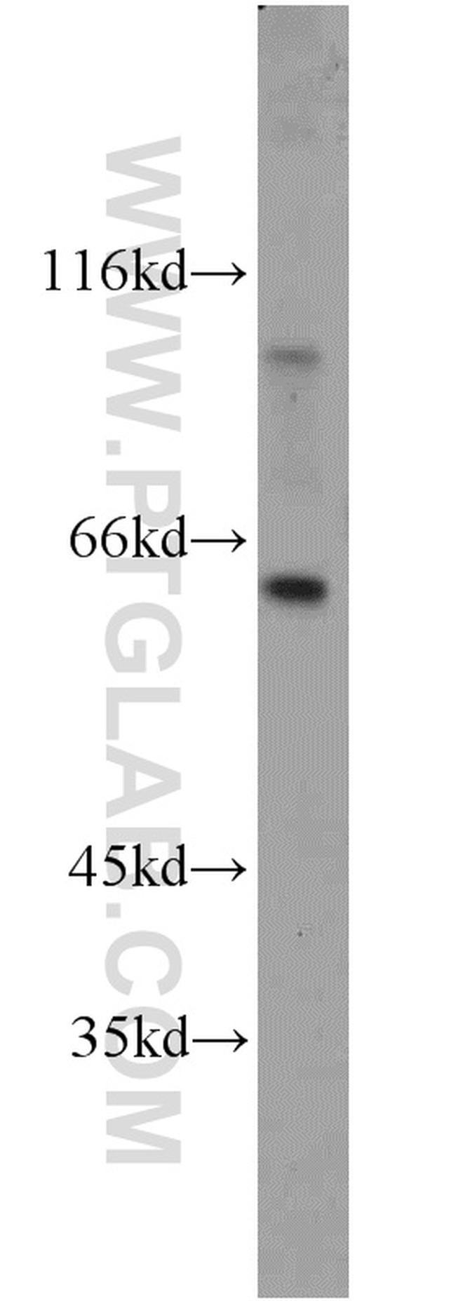 YME1L1 Antibody in Western Blot (WB)