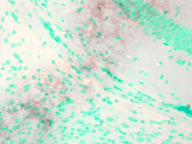 KCNQ1 K+ Channel Antibody in Immunohistochemistry (PFA fixed) (IHC (PFA))