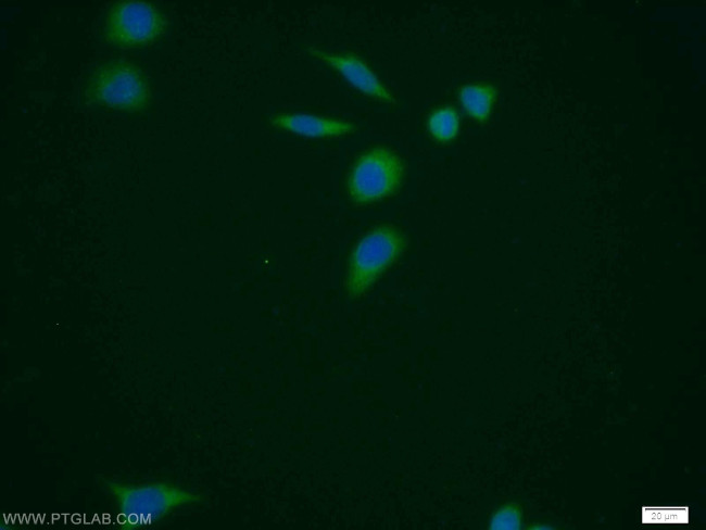 PUS1 Antibody in Immunocytochemistry (ICC/IF)