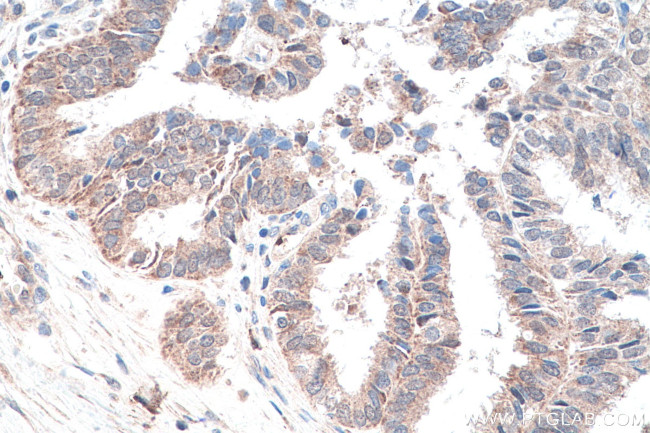 PUS1 Antibody in Immunohistochemistry (Paraffin) (IHC (P))