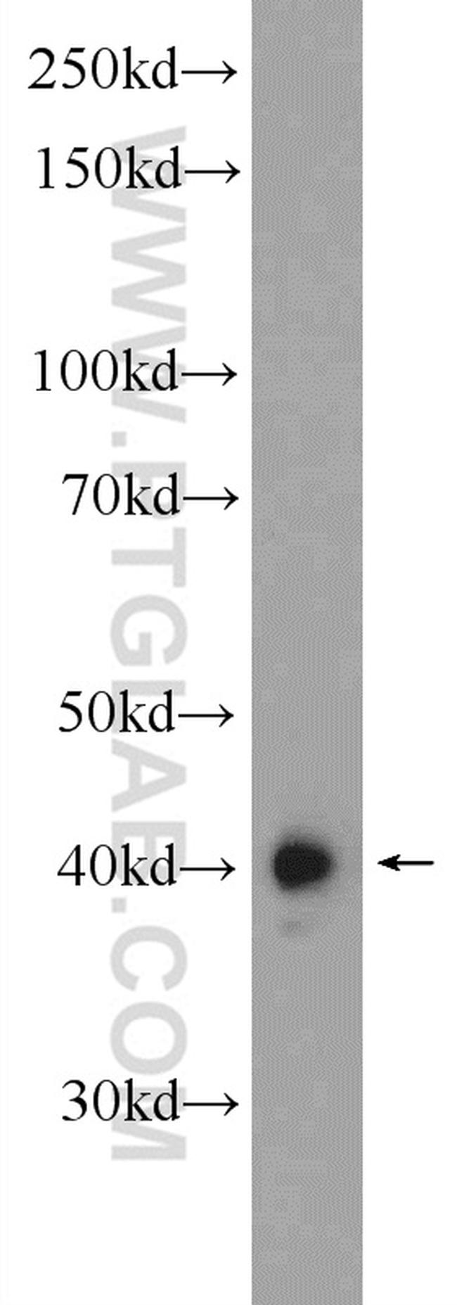 PUS1 Antibody in Western Blot (WB)