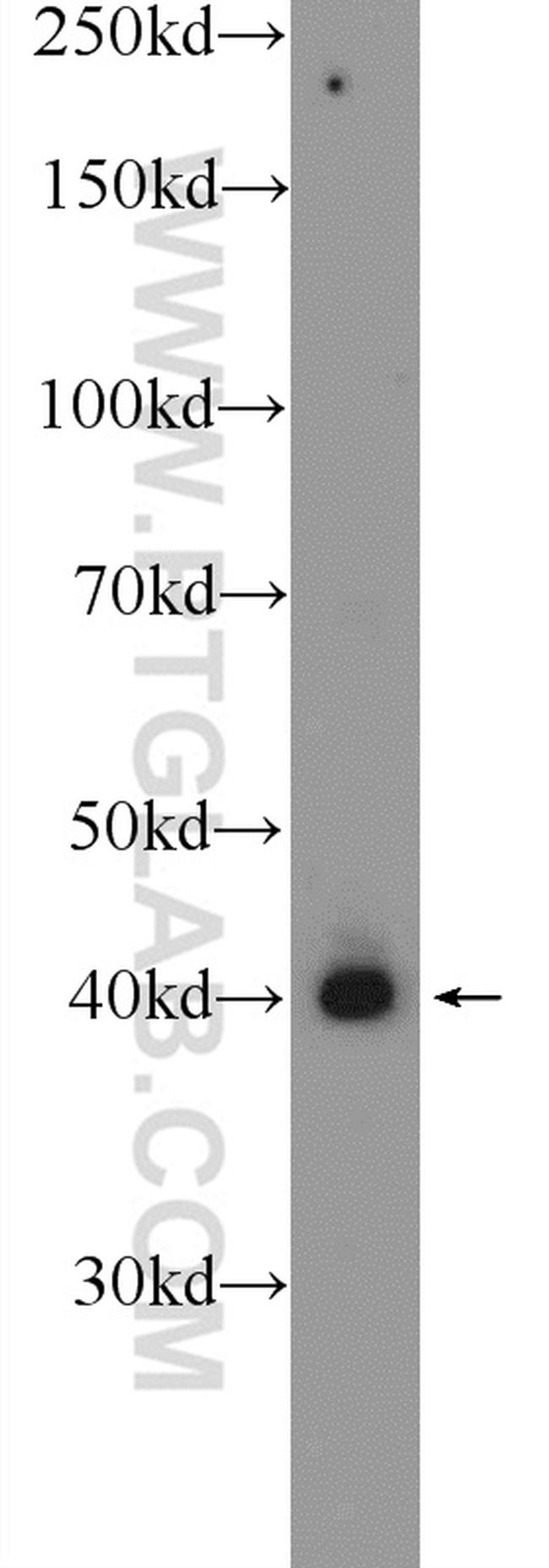 PUS1 Antibody in Western Blot (WB)