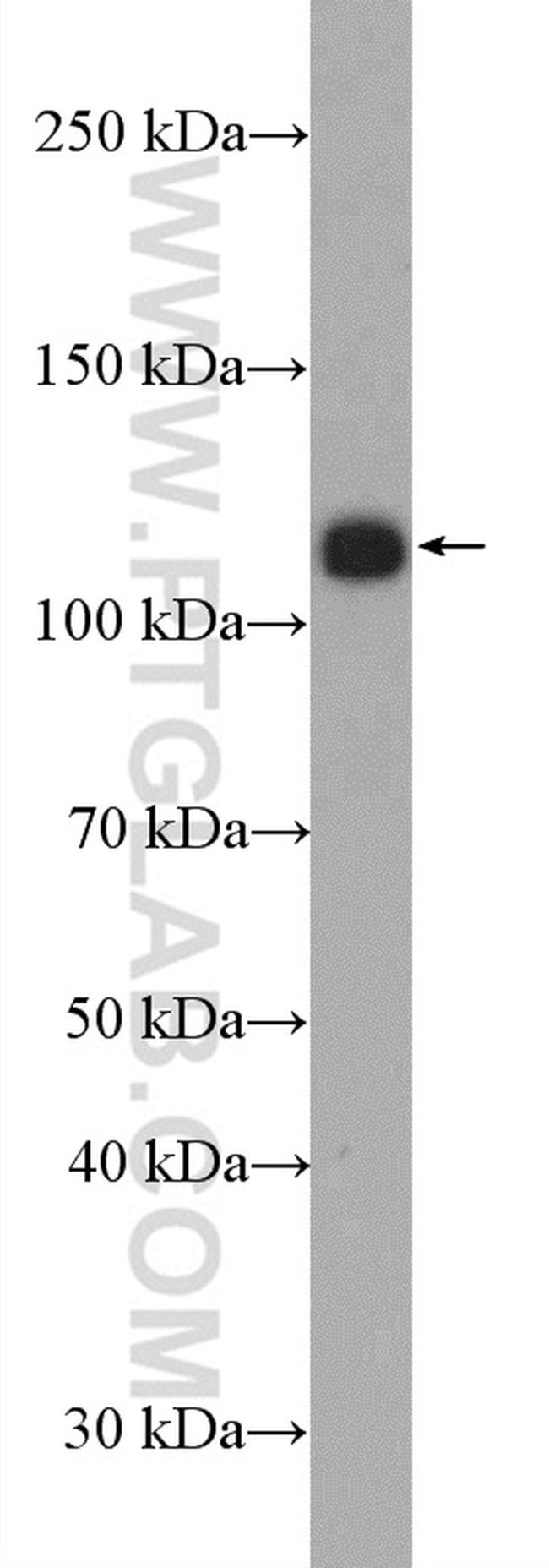 PHF15 Antibody in Western Blot (WB)