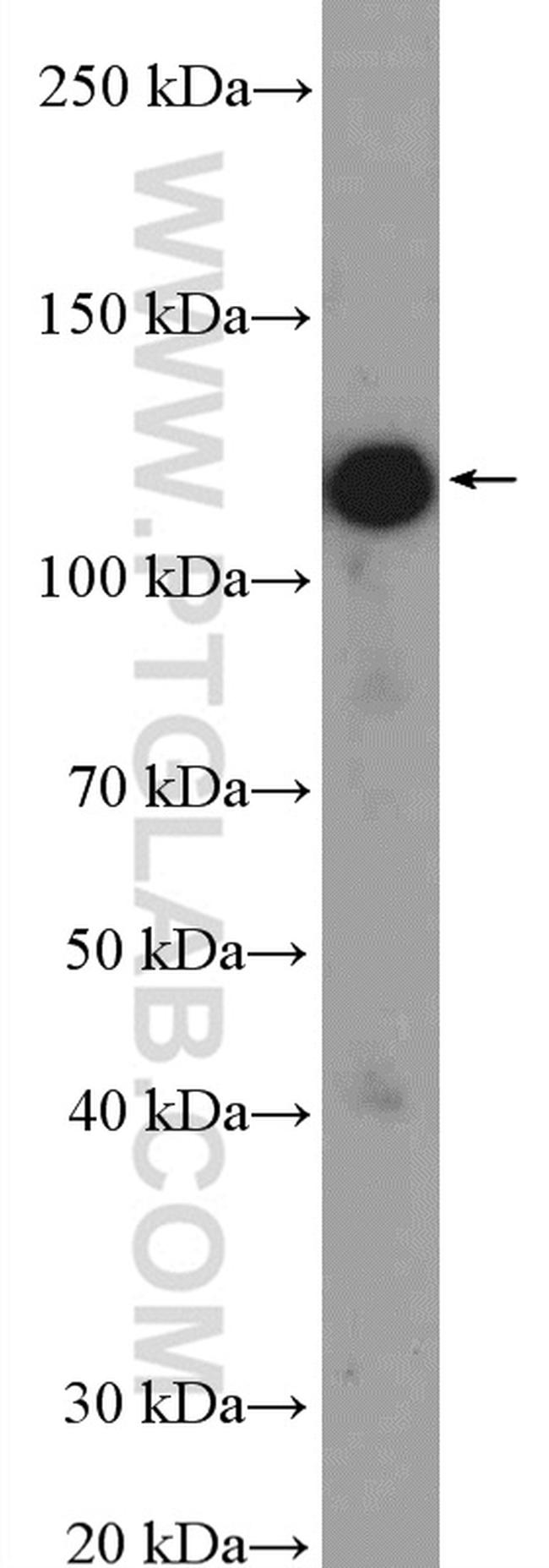 PHF15 Antibody in Western Blot (WB)