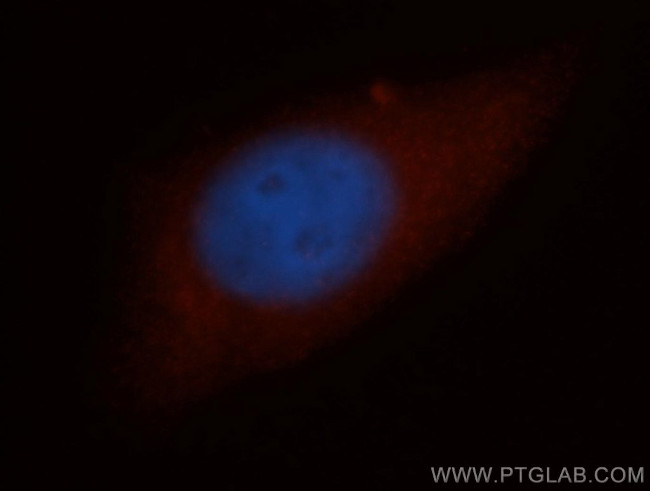 NCAPH Antibody in Immunocytochemistry (ICC/IF)