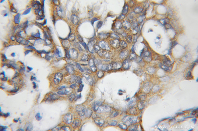 NCAPH Antibody in Immunohistochemistry (Paraffin) (IHC (P))