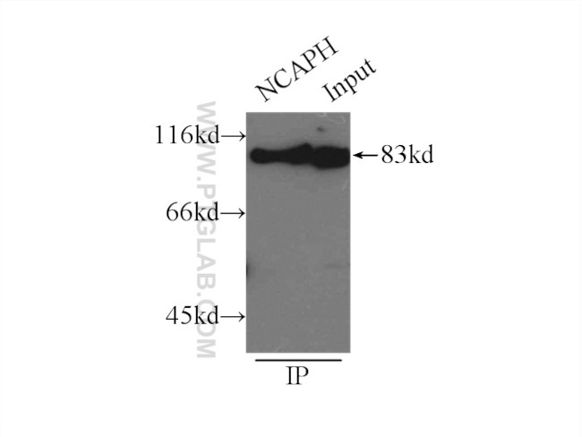 NCAPH Antibody in Immunoprecipitation (IP)