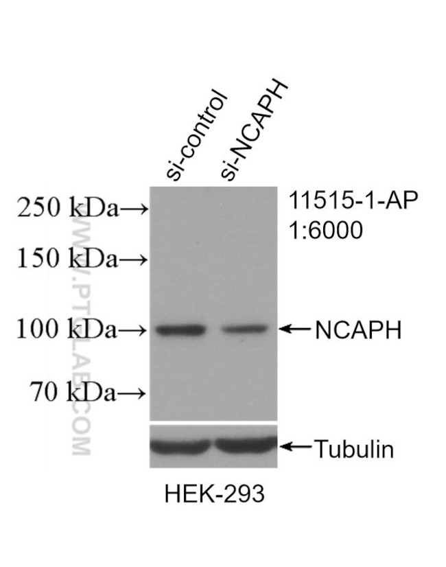 NCAPH Antibody in Western Blot (WB)