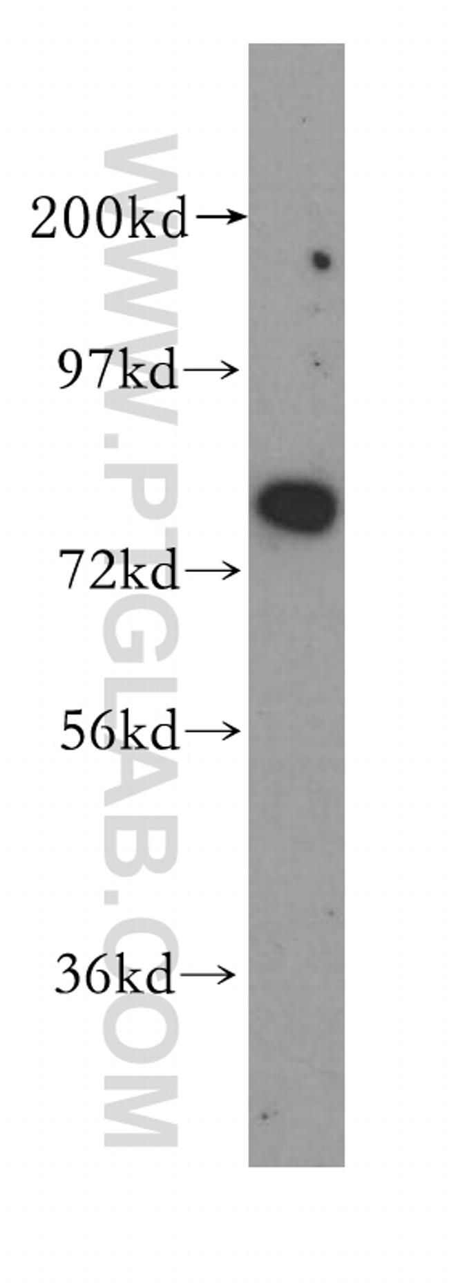 NCAPH Antibody in Western Blot (WB)