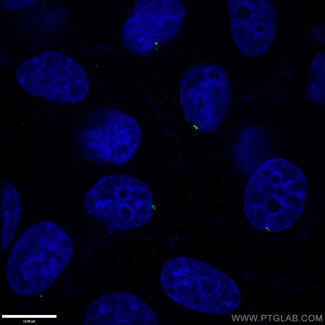 CENPJ Antibody in Immunocytochemistry (ICC/IF)