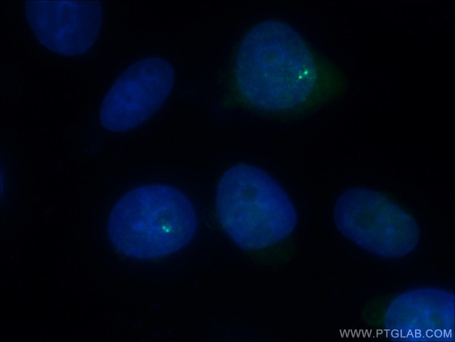 CENPJ Antibody in Immunocytochemistry (ICC/IF)