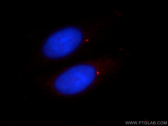 CENPJ Antibody in Immunocytochemistry (ICC/IF)