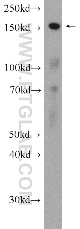 CENPJ Antibody in Western Blot (WB)