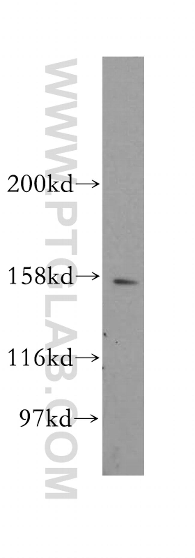 CENPJ Antibody in Western Blot (WB)