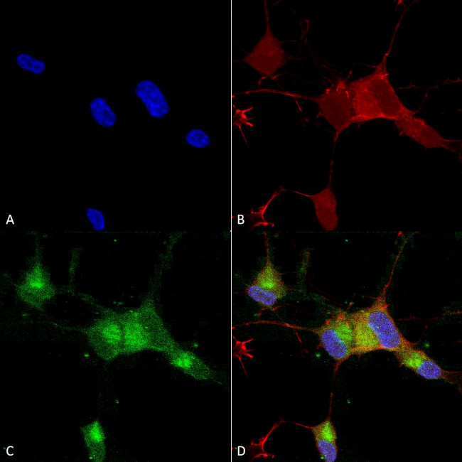 Nav1.7 Na+ Channel Antibody in Immunocytochemistry (ICC/IF)