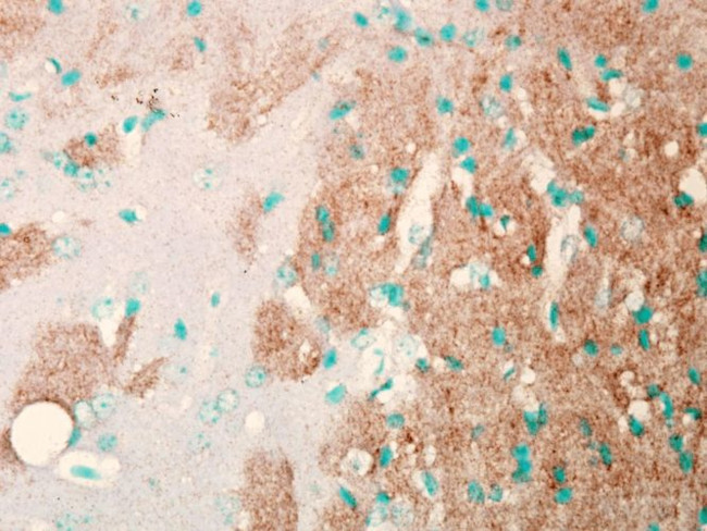 Nav1.7 Na+ Channel Antibody in Immunohistochemistry (Frozen) (IHC (F))