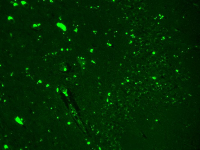 Nav1.7 Na+ Channel Antibody in Immunohistochemistry (Paraffin) (IHC (P))