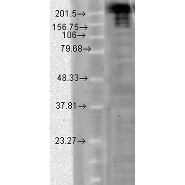 Nav1.7 Na+ Channel Antibody in Western Blot (WB)