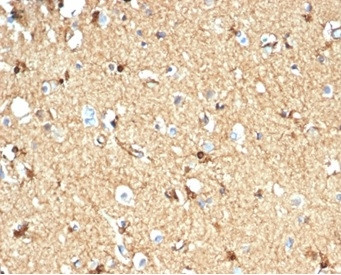 Creatine Phosphokinase-BB (CK-BB) Antibody in Immunohistochemistry (Paraffin) (IHC (P))