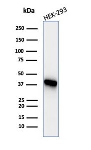 Creatine Phosphokinase-BB (CK-BB) Antibody in Western Blot (WB)