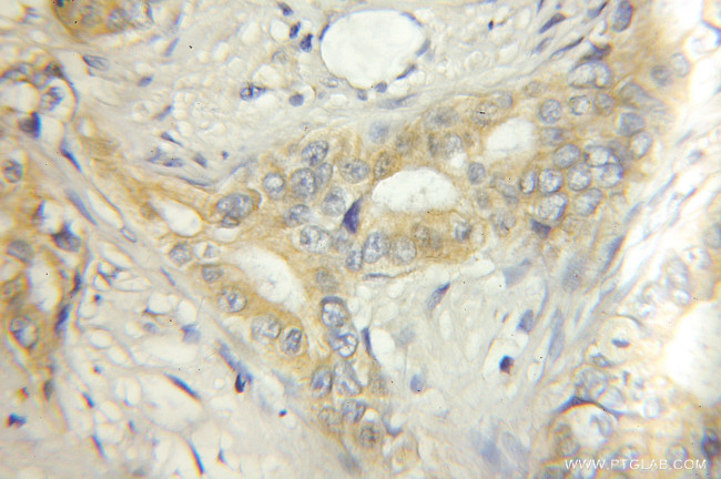 ECM1 Antibody in Immunohistochemistry (Paraffin) (IHC (P))