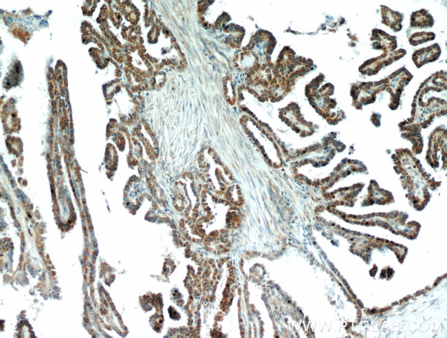 ECM1 Antibody in Immunohistochemistry (Paraffin) (IHC (P))