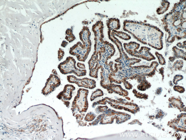 ECM1 Antibody in Immunohistochemistry (Paraffin) (IHC (P))