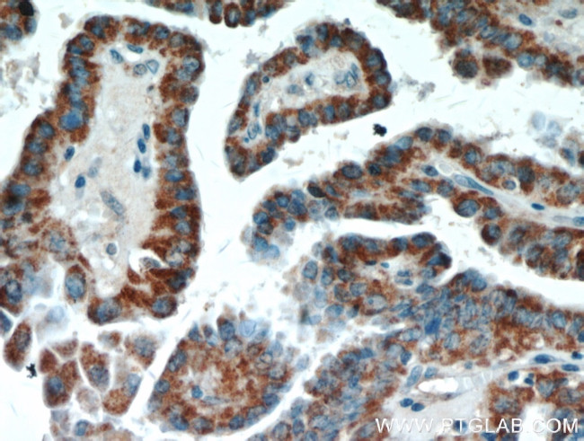 ECM1 Antibody in Immunohistochemistry (Paraffin) (IHC (P))