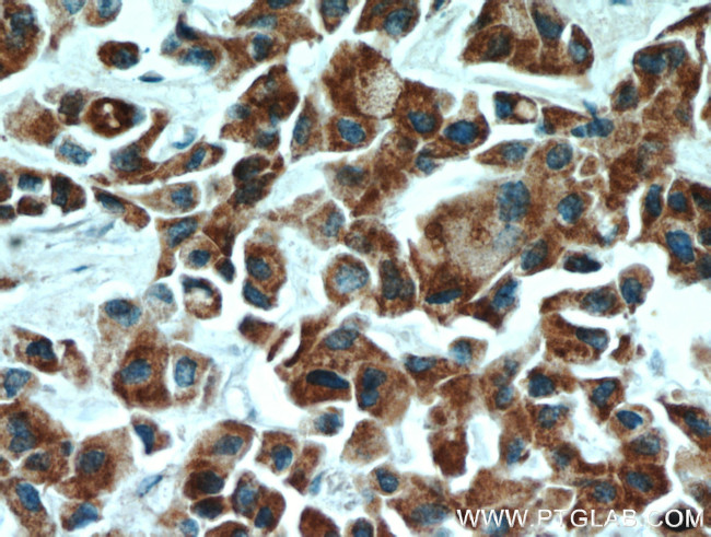 ECM1 Antibody in Immunohistochemistry (Paraffin) (IHC (P))