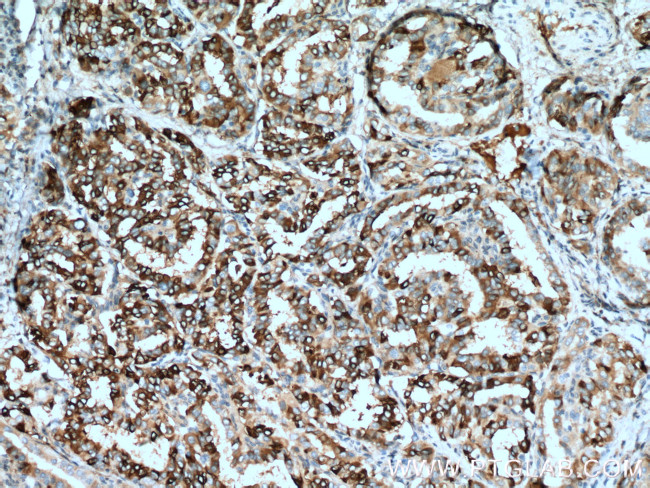 ECM1 Antibody in Immunohistochemistry (Paraffin) (IHC (P))