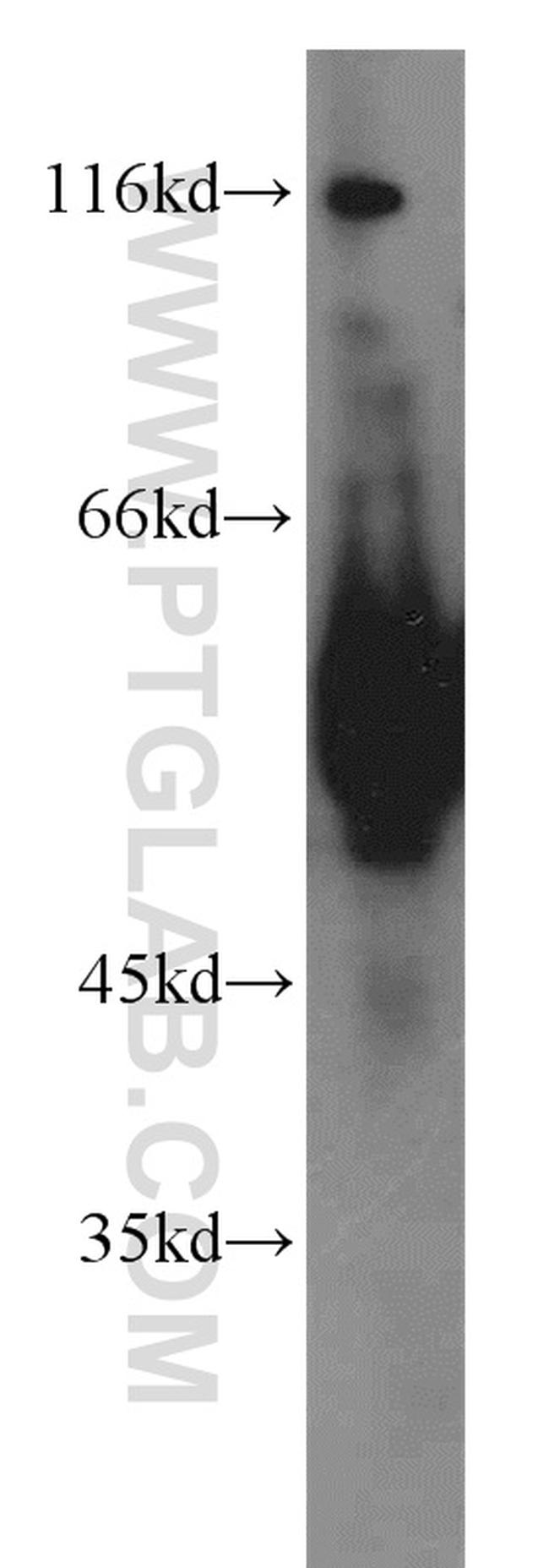 ECM1 Antibody in Western Blot (WB)