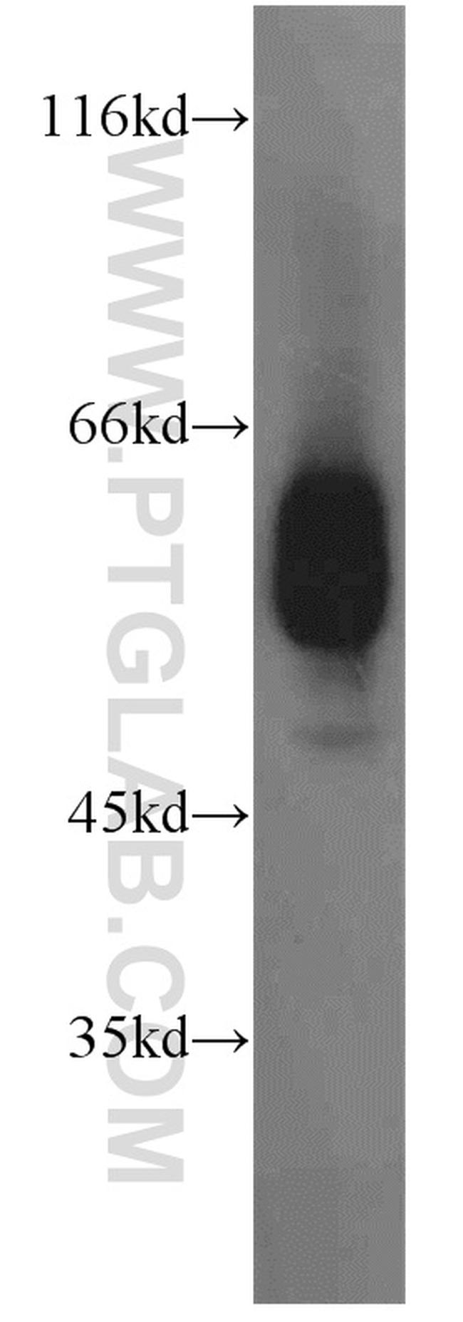 ECM1 Antibody in Western Blot (WB)