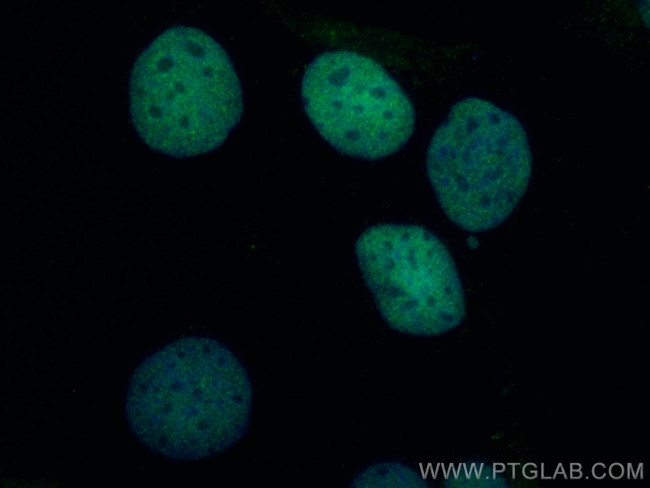 TGIF2 Antibody in Immunocytochemistry (ICC/IF)