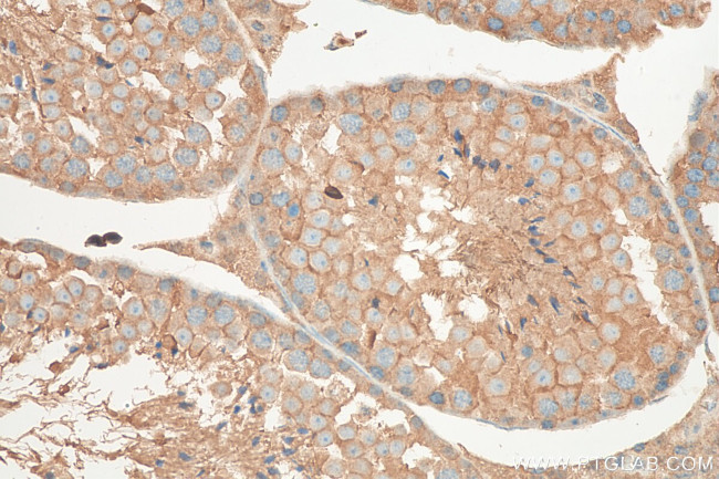 TGIF2 Antibody in Immunohistochemistry (Paraffin) (IHC (P))