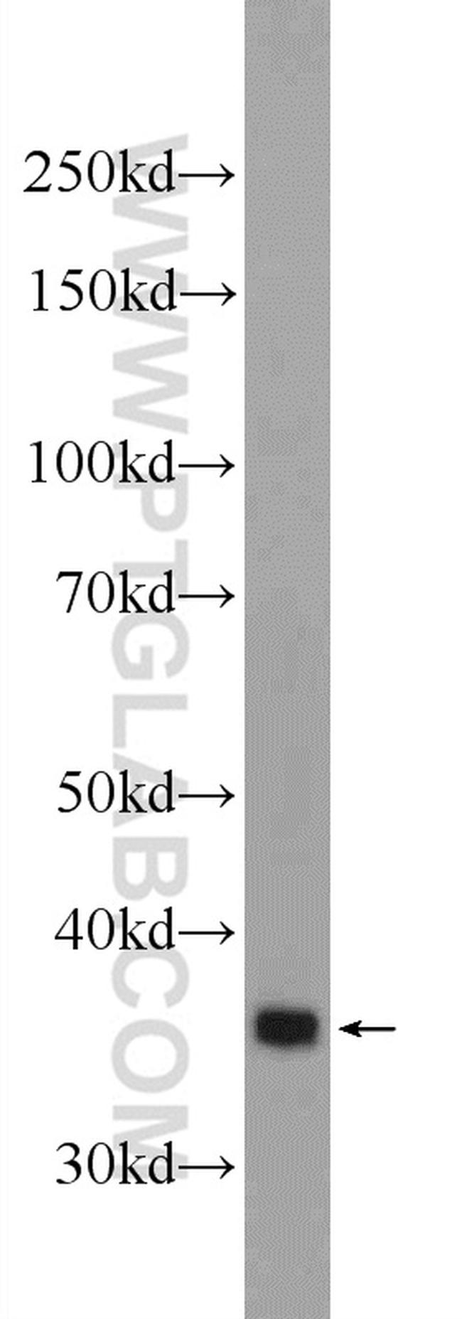 TGIF2 Antibody in Western Blot (WB)