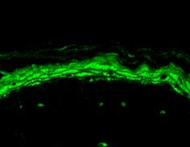 Nav1.8 Na+ Channel Antibody in Immunohistochemistry (Paraffin) (IHC (P))