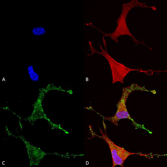 Cav beta Ca+2 Channel Antibody in Immunocytochemistry (ICC/IF)