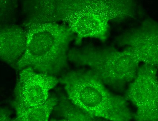 Cav beta Ca+2 Channel Antibody in Immunocytochemistry (ICC/IF)