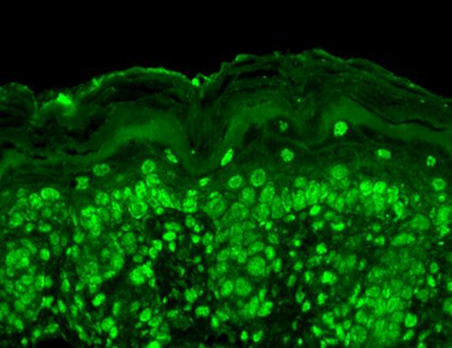 Cav beta Ca+2 Channel Antibody in Immunohistochemistry (Paraffin) (IHC (P))