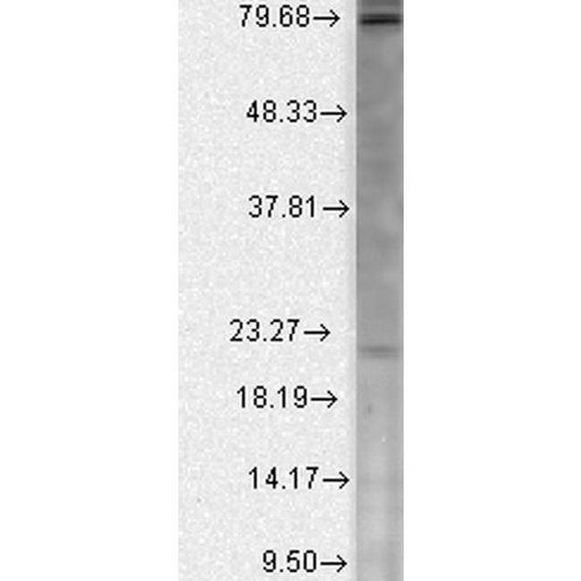 Cav beta Ca+2 Channel Antibody in Western Blot (WB)