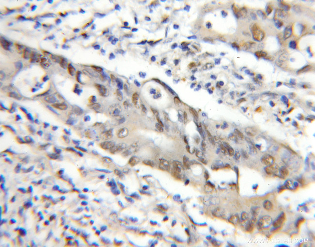 MEPCE Antibody in Immunohistochemistry (Paraffin) (IHC (P))