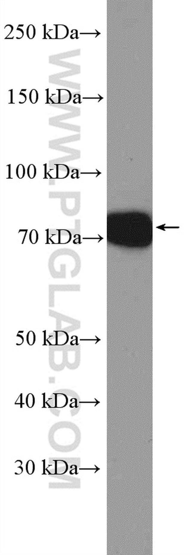 MEPCE Antibody in Western Blot (WB)