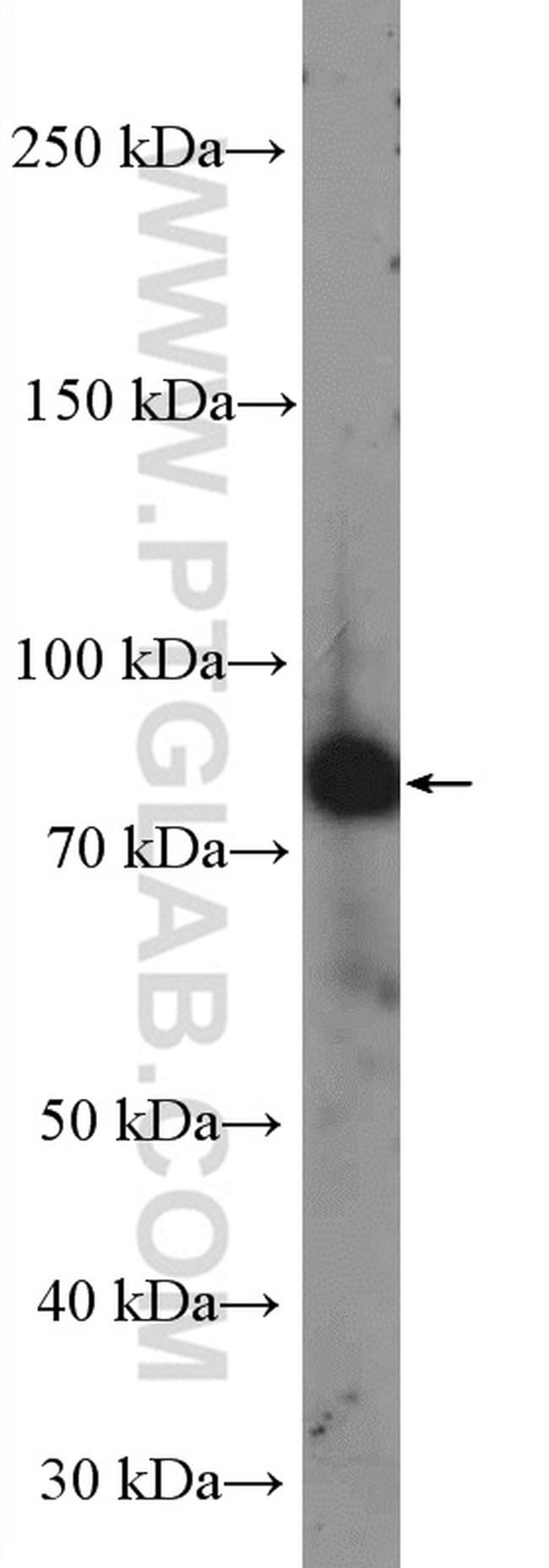 MEPCE Antibody in Western Blot (WB)