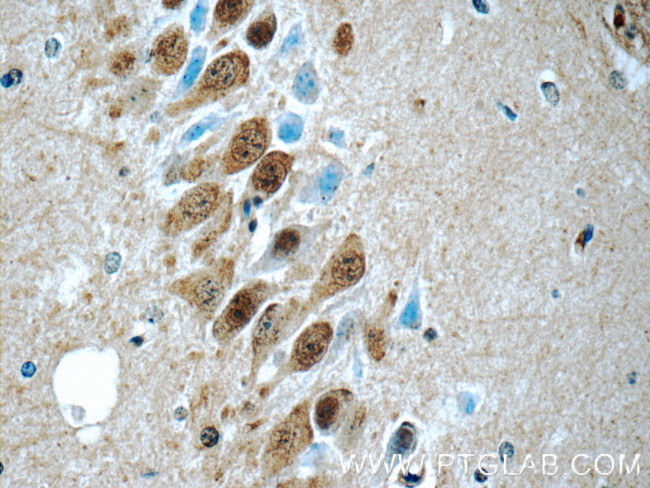 UCHL5 Antibody in Immunohistochemistry (Paraffin) (IHC (P))