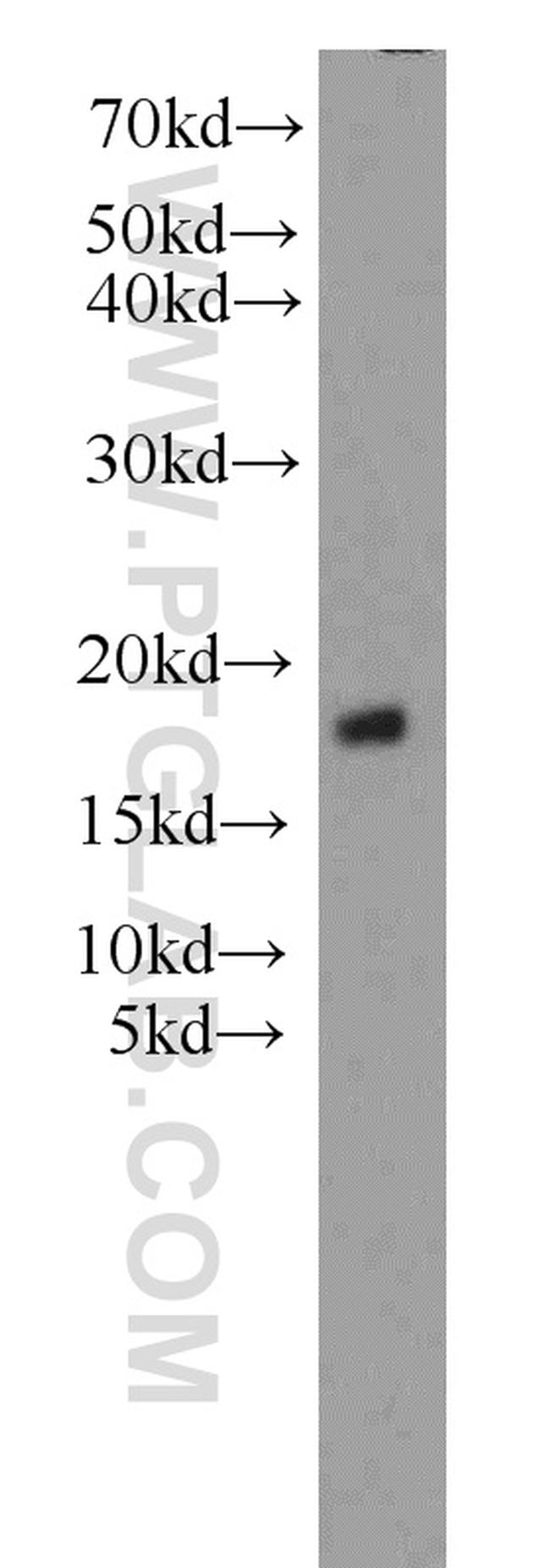 SRP14 Antibody in Western Blot (WB)